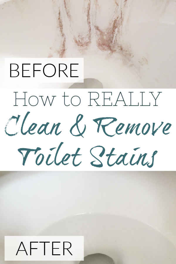 Tough toilet stains? No worries. All you need is one common item to totally get rid of them.