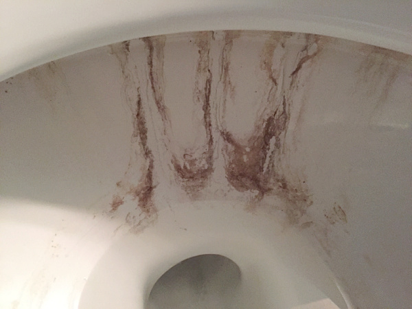 Stubborn brown toilet stain